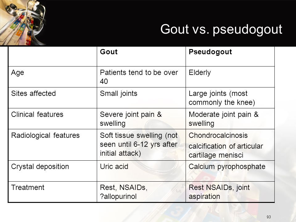 gout vs pseudogout crystals